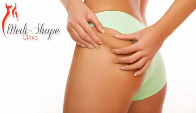 75% Off Diet Consultation from Medi-Shape Clinic, Kaslik (Only $15 instead of $60)