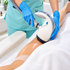 30 min Velashape Treatment Session