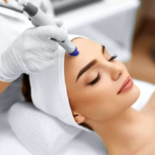 Microneedling Treatment Session