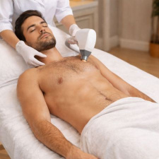 1-Session Full Body Laser For Men Upper Body, Legs & Arms